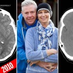 Kilenc daganata volt, mind eltűnt!