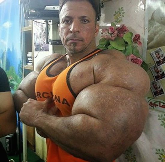 Szteroid és synthol: megtalálták a világ legocsmányabb testépítőjét