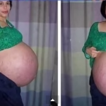 Azt hitték egyszerű terhesség! Hát nem az volt! A világon először fordult elő ilyen
